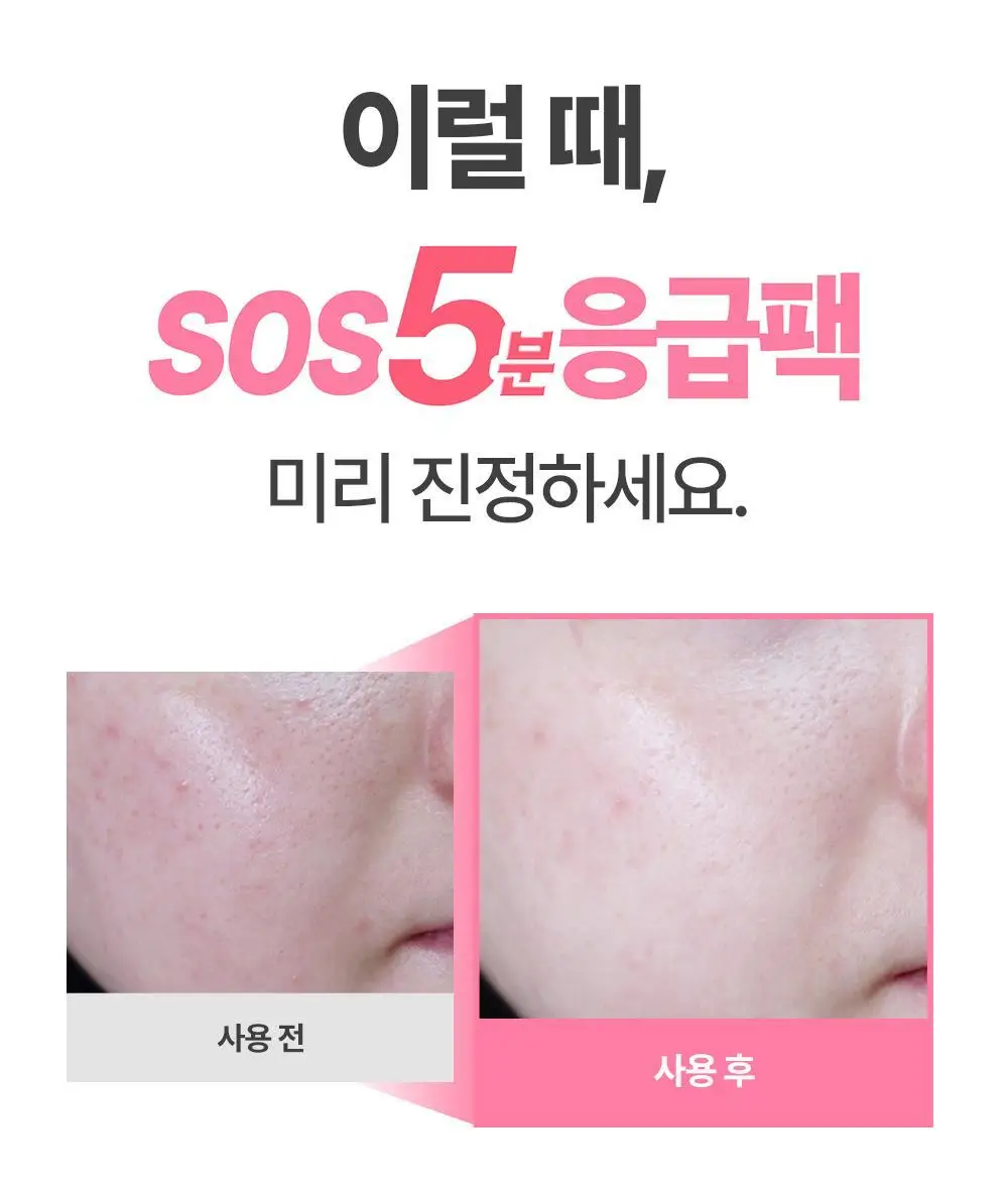 [진정/피지케어] 아페리레 스파 릴리프 베리 프리티 포어 마스크 120g 상세페이지 5